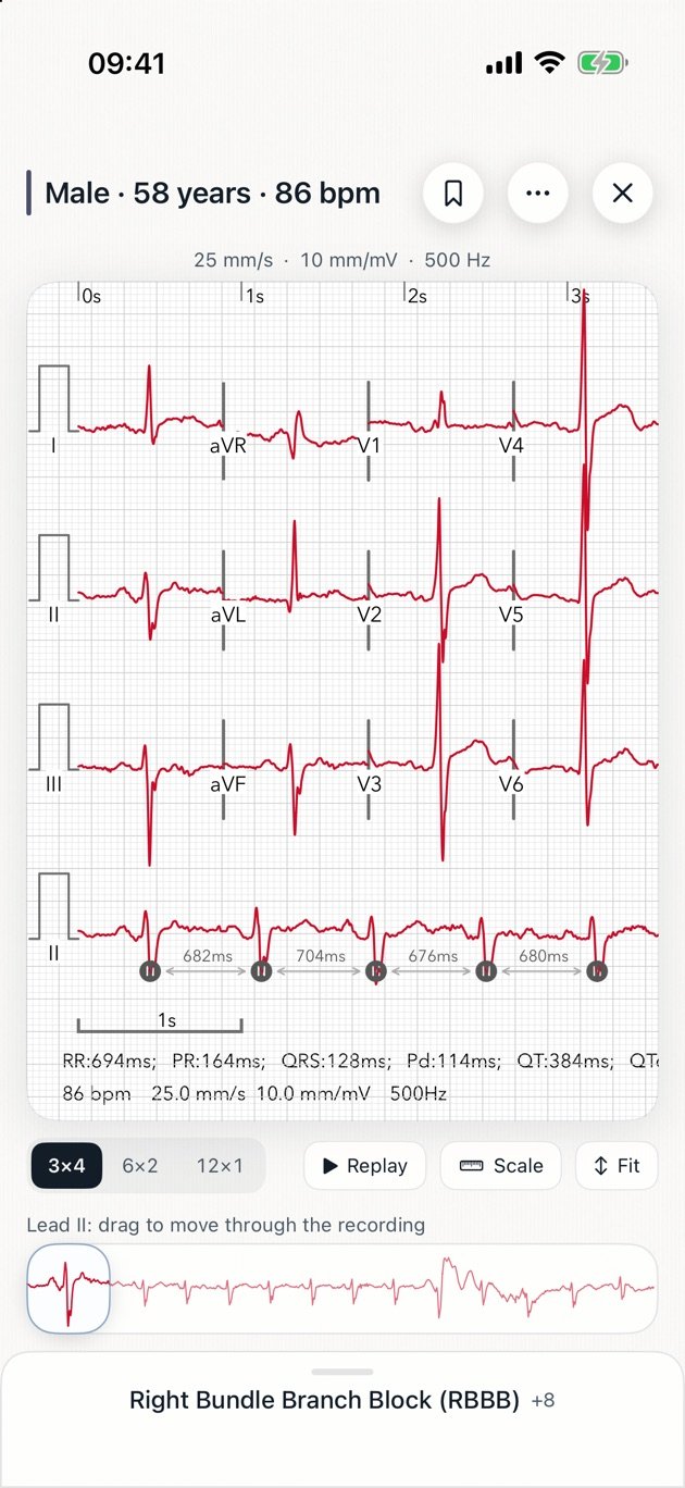 ECG Pro case page showing a 12-lead recording with RR intervals and measured PR, QRS and QT